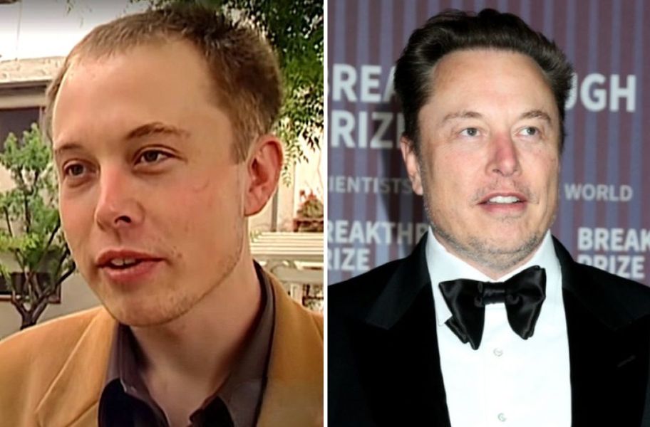 elon-musk-hair-transplant-1-1776756982736181587662-1777006964012-1777006964204846980711 Bệnh hói đầu sắp ”tuyệt chủng” đến nơi: Huyết thanh từ thực vật giúp tóc dày lên 25% chỉ trong 56 ngày - Ảnh 2.